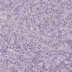 Immunohistochemical staining of human pancreas shows low expression as expected.