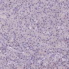 Immunohistochemical staining of human pancreas shows low expression as expected.