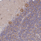 Immunohistochemical staining of human cerebellum shows moderate cytoplasmic positivity in Purkinje cells.