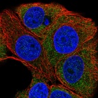 Immunofluorescent staining of human cell line MCF7 shows localization to cytosol.