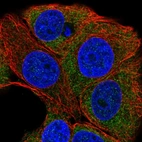 Immunofluorescent staining of human cell line MCF7 shows localization to cytosol.