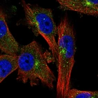Anti-EVI5 Antibody