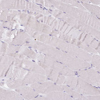 Immunohistochemical staining of human skeletal muscle shows no positivity in myocytes as expected.