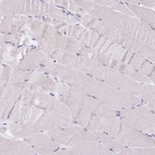 Immunohistochemical staining of human skeletal muscle shows no positivity in myocytes as expected.