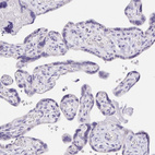 Immunohistochemical staining of human placenta shows no positivity in trophoblastic cells as expected.
