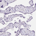 Immunohistochemical staining of human placenta shows no positivity in trophoblastic cells as expected.
