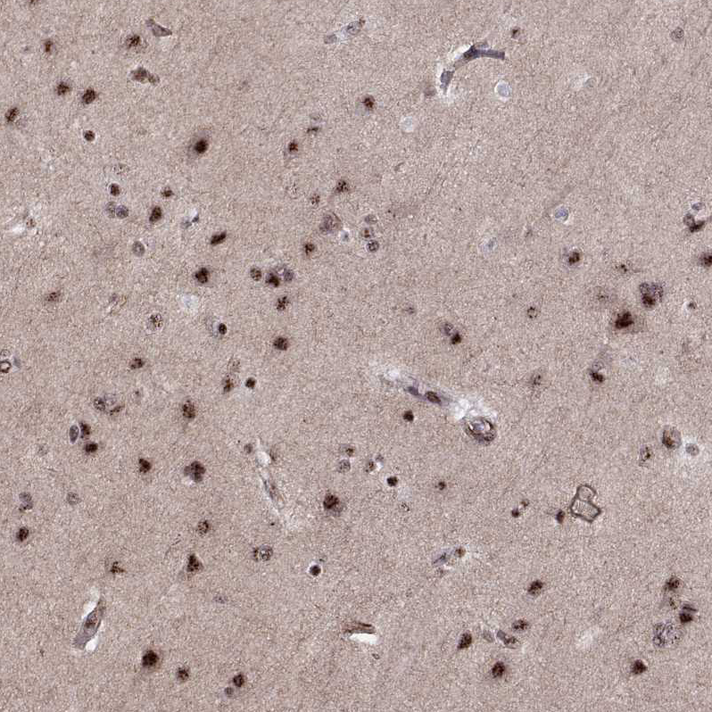 Anti-ZCCHC17 Antibody