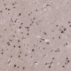 Anti-ZCCHC17 Antibody