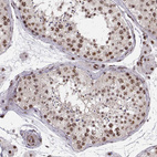 Immunohistochemical staining of human testis shows strong positivity in nucleoli in cells in seminiferous ducts.