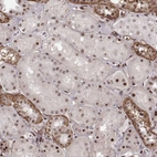 Immunohistochemical staining of human kidney shows moderate positivity in nucleoli in cells in tubules.