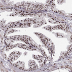 Immunohistochemical staining of human prostate shows strong positivity in nucleoli in glandular cells.