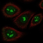 Anti-TAS2R5 Antibody