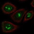 Anti-TAS2R5 Antibody