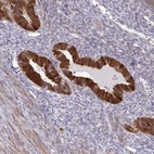 Anti-CMPK1 Antibody