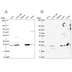 Western blot analysis using Anti-CMPK1 antibody HPA053730 (A) shows similar pattern to independent antibody HPA058604 (B).