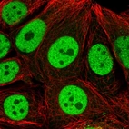 Immunofluorescent staining of human cell line MCF7 shows localization to nucleoplasm.