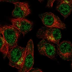 Anti-SLA2 Antibody