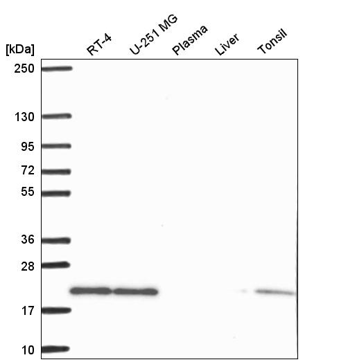 Anti-SKP1 Antibody