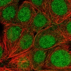 Immunofluorescent staining of human cell line MCF7 shows localization to nucleus & cytosol.