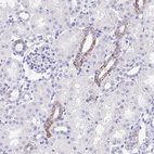 Anti-MON1A Antibody
