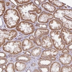 Anti-DLEU7 Antibody