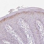 Anti-ZNF814 Antibody