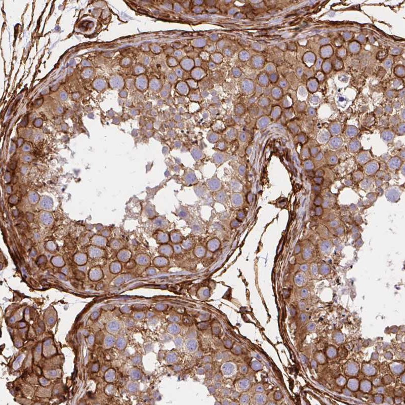 Anti-MAP1LC3B Antibody