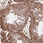 Anti-MAP1LC3B Antibody