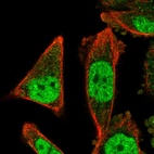 Immunofluorescent staining of human cell line PC-3 shows localization to nucleoplasm & cytosol.