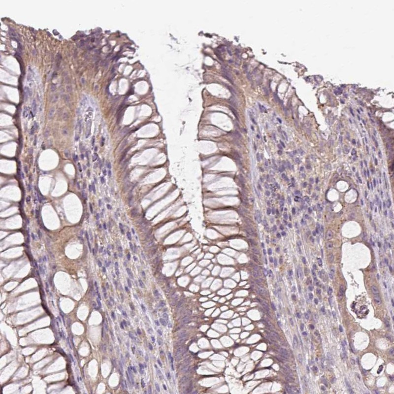 Anti-UBL3 Antibody