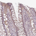 Anti-UBL3 Antibody