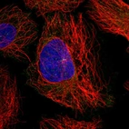 Immunofluorescent staining of human cell line U-2 OS shows localization to centrosome.