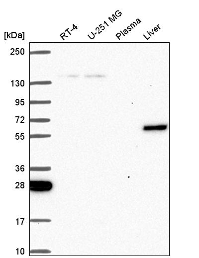 Anti-TOE1 Antibody