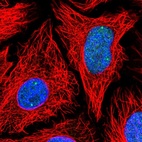 Immunofluorescent staining of human cell line HeLa shows localization to nucleoplasm & nuclear bodies.