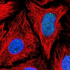 Immunofluorescent staining of human cell line HeLa shows localization to nucleoplasm & nuclear bodies.