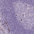 Anti-ARRDC2 Antibody