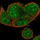Immunofluorescent staining of human cell line PC-3 shows localization to nucleoplasm & cytosol.