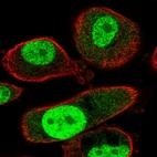 Anti-TMEM184A Antibody