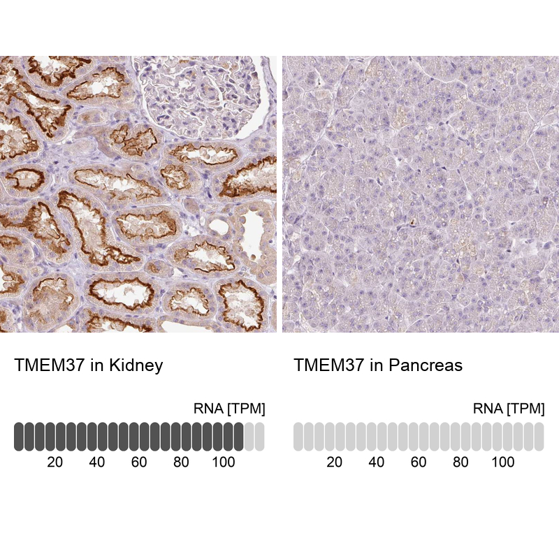 Anti-TMEM37 Antibody