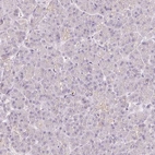 Immunohistochemical staining of human pancreas shows low expression as expected.