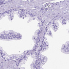 Immunohistochemical staining of human prostate shows no positivity in glandular cells as expected.
