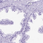 Immunohistochemical staining of human prostate shows no positivity in glandular cells as expected.