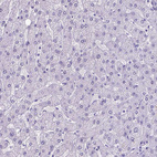 Immunohistochemical staining of human liver shows no positivity in hepatocytes as expected.