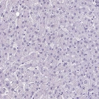 Immunohistochemical staining of human liver shows no positivity in hepatocytes as expected.