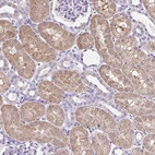 Anti-CTU1 Antibody
