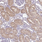 Anti-CTU1 Antibody