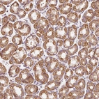 Anti-PRSS48 Antibody