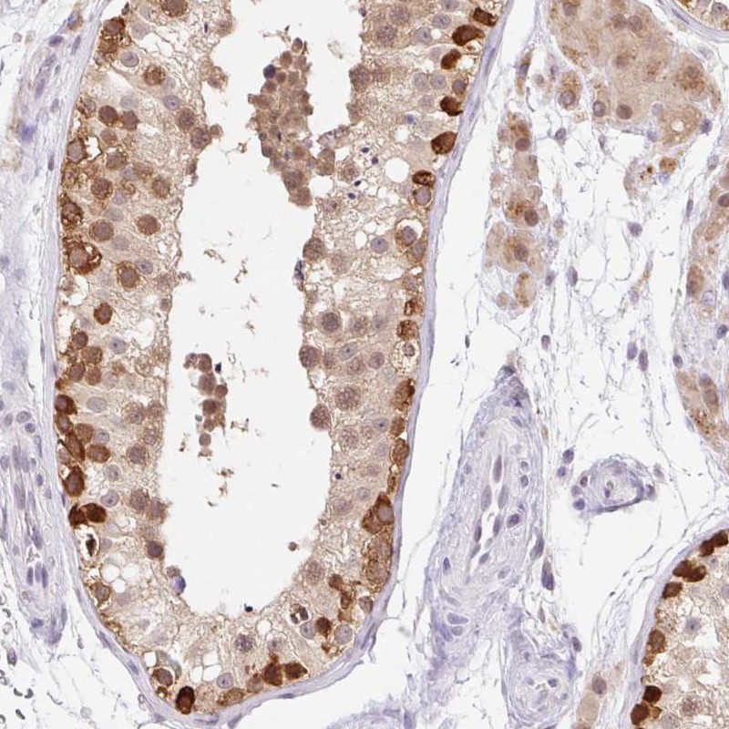 Anti-SRSF10 Antibody