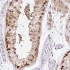 Anti-SRSF10 Antibody
