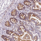 Immunohistochemical staining of human small intestine shows moderate cytoplasmic positivity in glandular cells.
